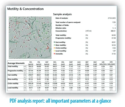 AndroScope®, For Mobile Semen Analysis Kit, Each